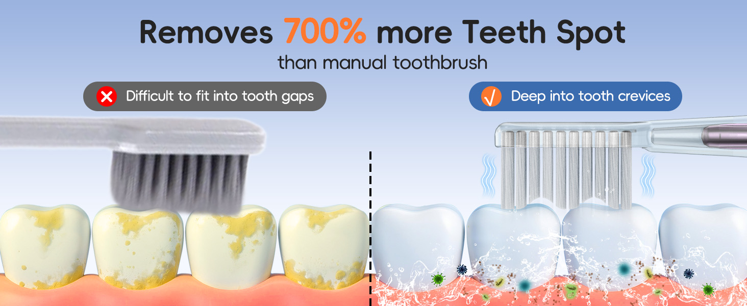 Removes 700% more Teeth Spotthan manual toothbrush