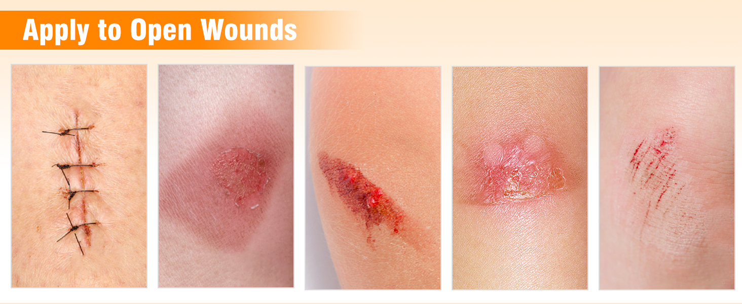 xeroform gauze dressing