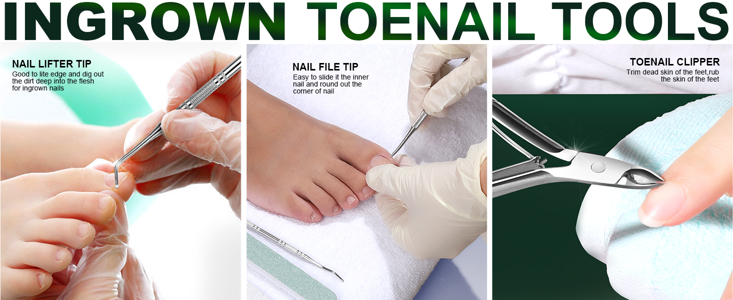 Ingrown Toenail Lifter