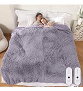 COZYTY Electric Blanket Queen Size, Super Cozy Luxury Faux Fur & Thick Sherpa Heated Blanket with...