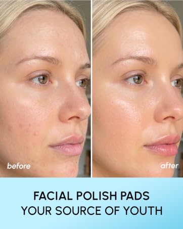 exfoliating pads for face, salicylic acid face wipes, skin resurfacing, glycolic pads