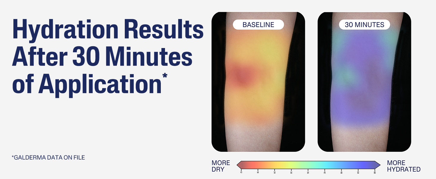 Hydration Results