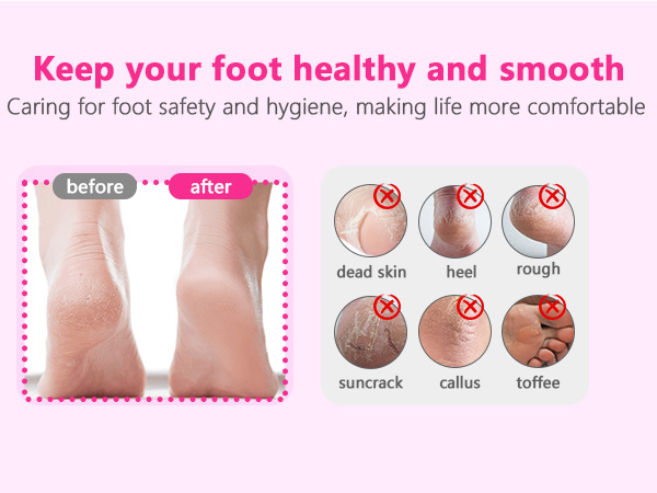FOOT FILE REPLACEMENT PADS