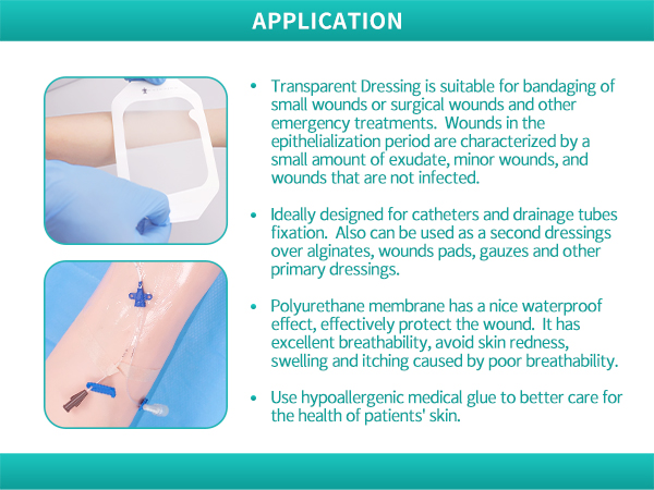 transparent film dressing