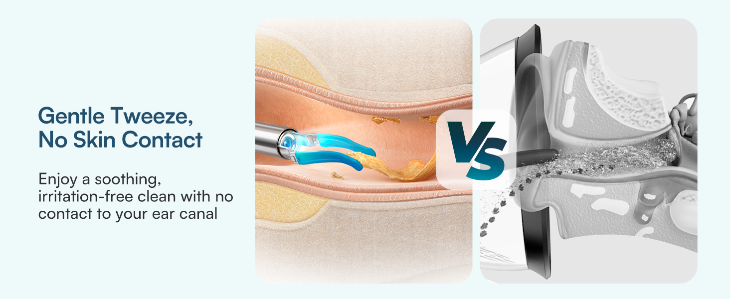 GentleTweeze,More Safer