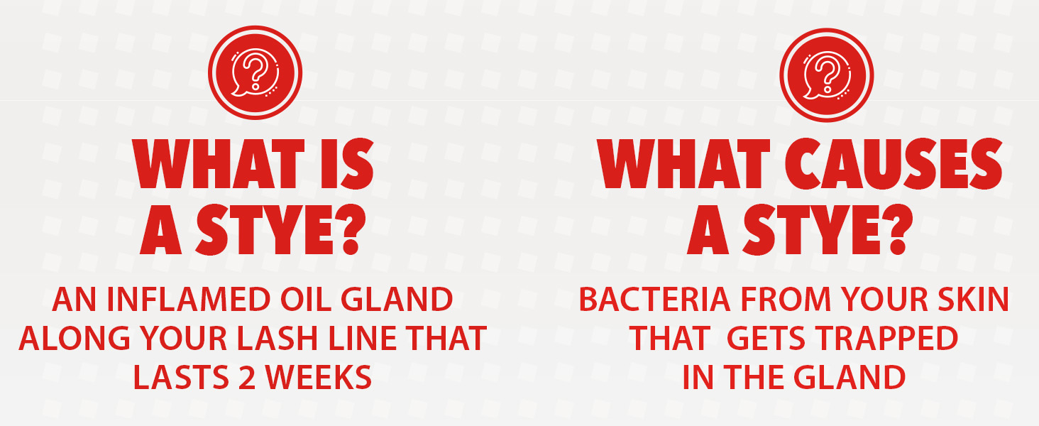 what is a stye