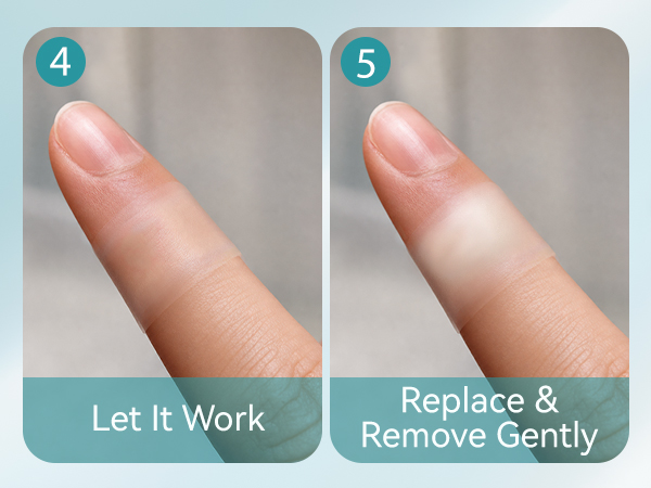 Hydrocolloid Gel Bandages
