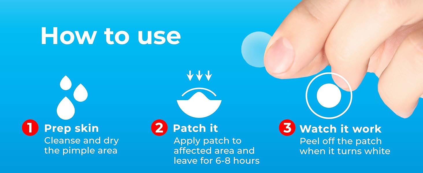 pimple patch, pimple patches, acne patches, pimple patches for face, acne treatment, acne