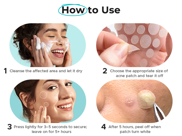 pimple patches