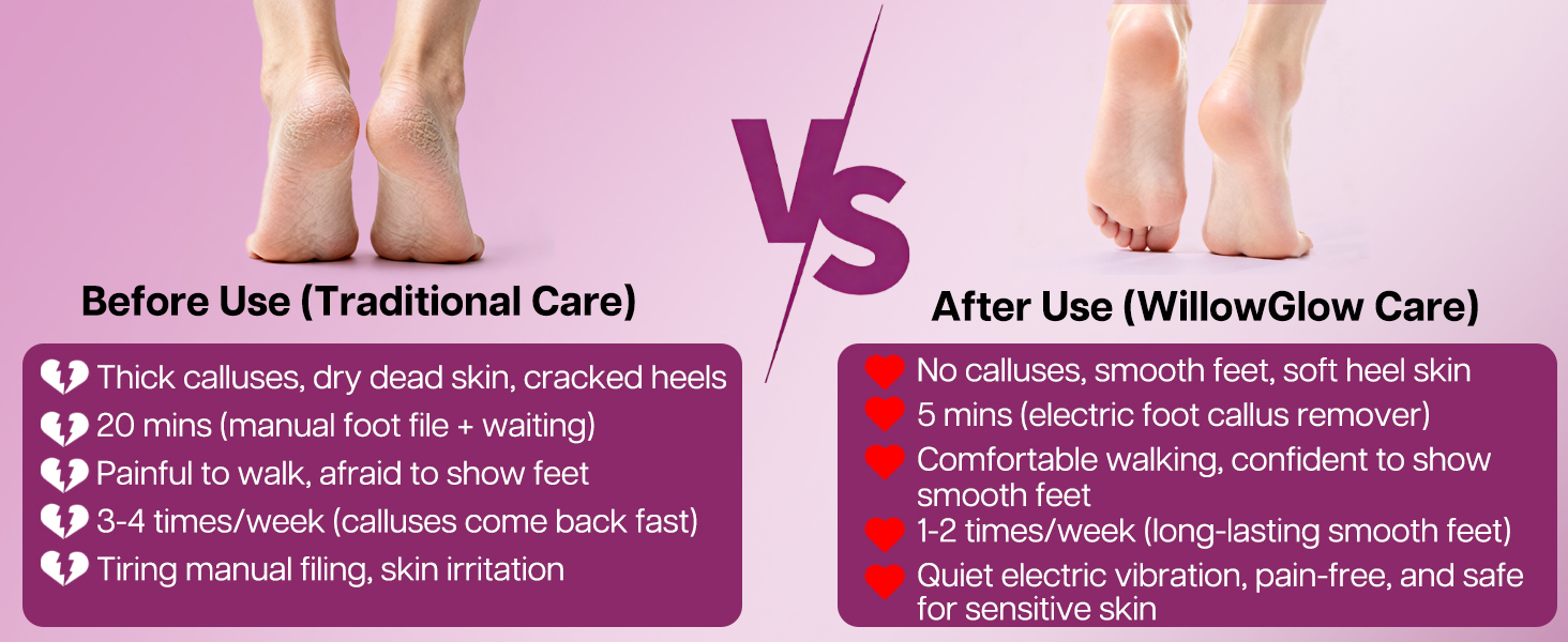 Before and after using the electric foot file: from painful calluses to smooth feet in minutes.