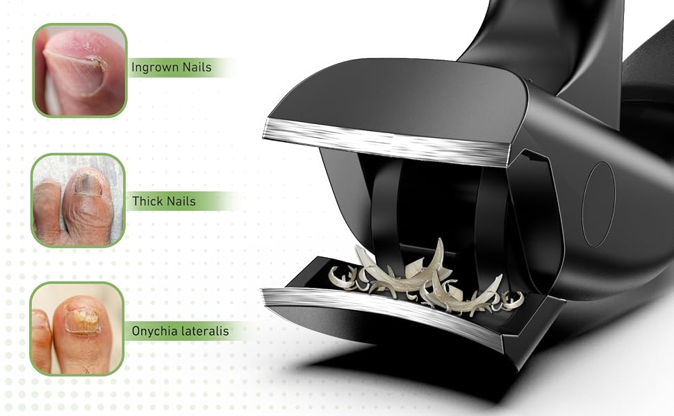 toenail clippers