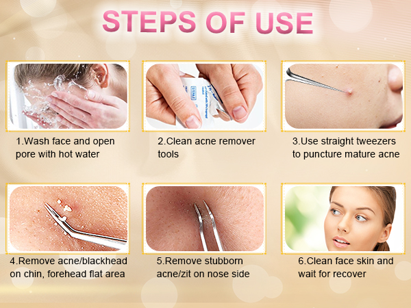 pimple extractor