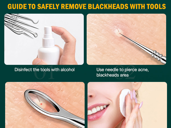 Blackhead and Acne Extractor Kit