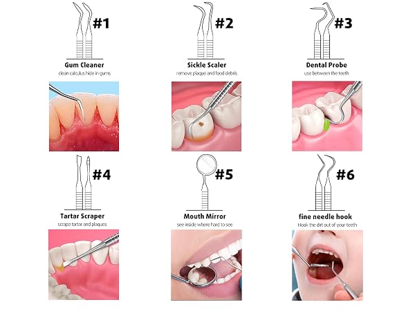 teeth cleaning kit