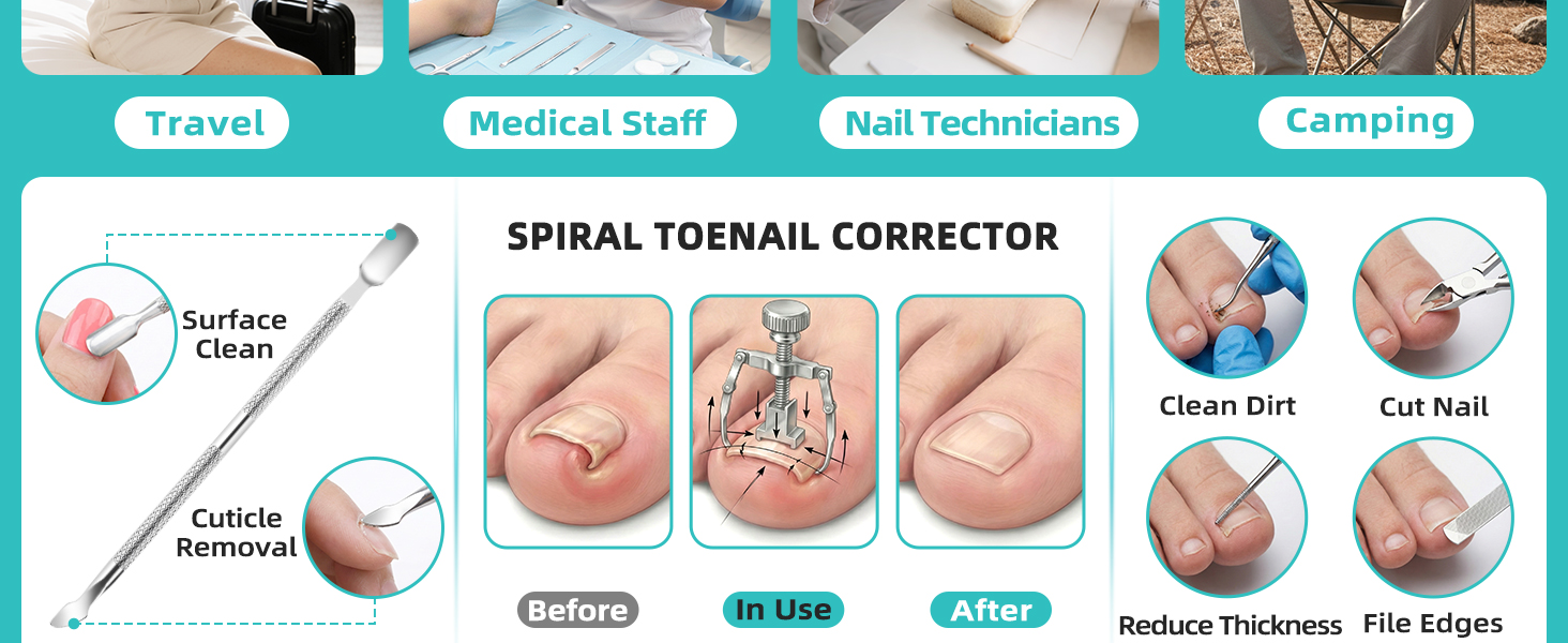 nail kit