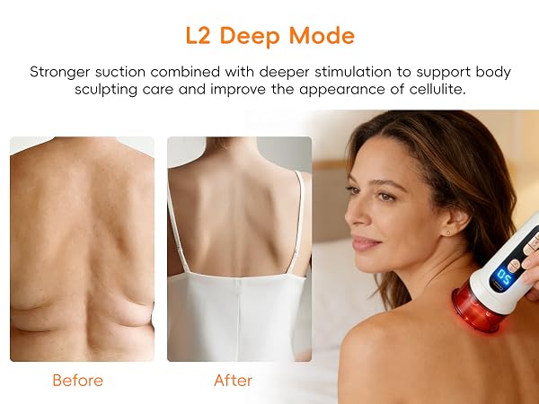 cellulite massage tool