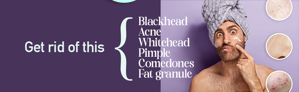 blackheads remover