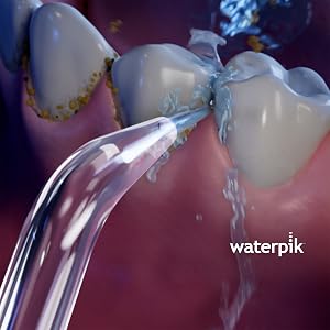 Using the Waterpik Precision Tip