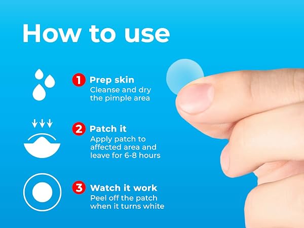 pimple patch, pimple patches, acne patches, pimple patches for face, acne treatment, acne