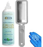 Foot Callus Remover Kit - Foot File & Callus Gel Feet Scrubber Dead Skin Scraper Bundle, 6oz