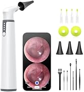 Wireless Otoscope with Gyroscope, Ear Camera with Dual View, 3.9 mm Otoscope with Light, Ear Scop...