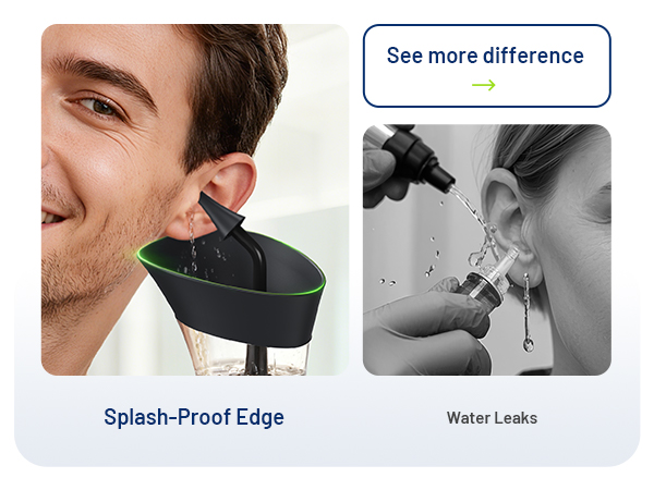 ear wax removal