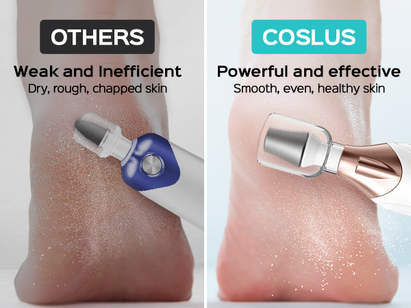 electric toenail clippers for seniors