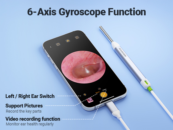 otoscope