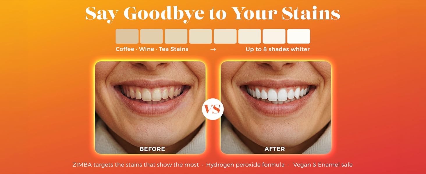 Say goodbye to your tooth stains, up to 8 shades whiter