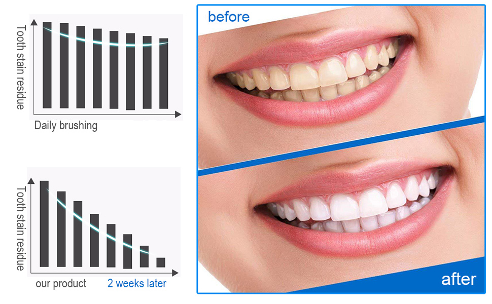 teeth