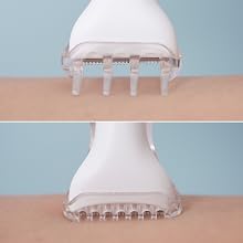 Skin Guard Attachement