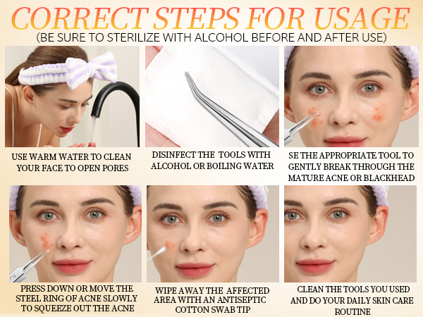 blackhead extractor
