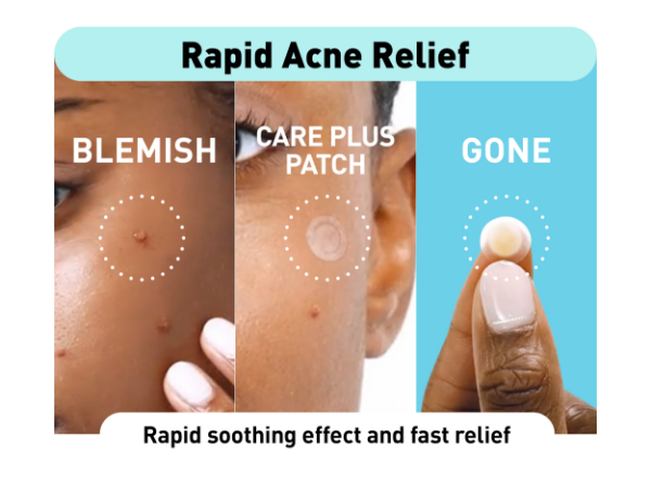 mighty patch pimple patch hero pimple patch