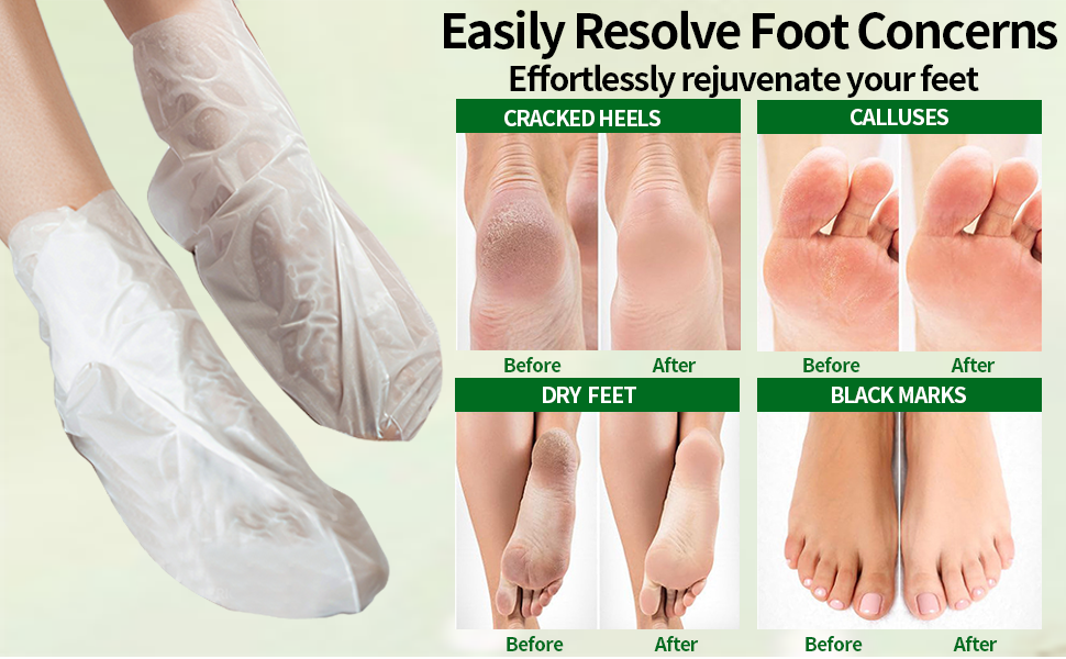 feet mask