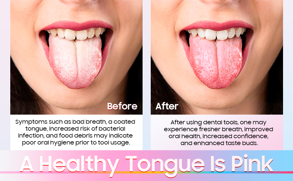 mens hygiene essentials baby tongue brush baby tongue scraper blue tongue skink cleaning scraper