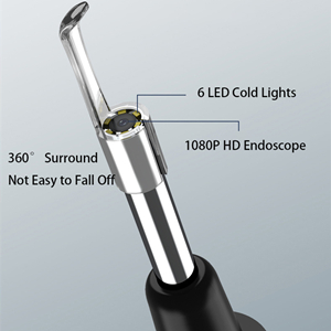 ear wax clog removal