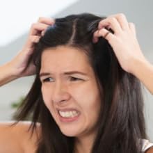 Itchy Scalp
