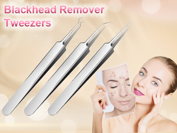 Blackhead tweezers