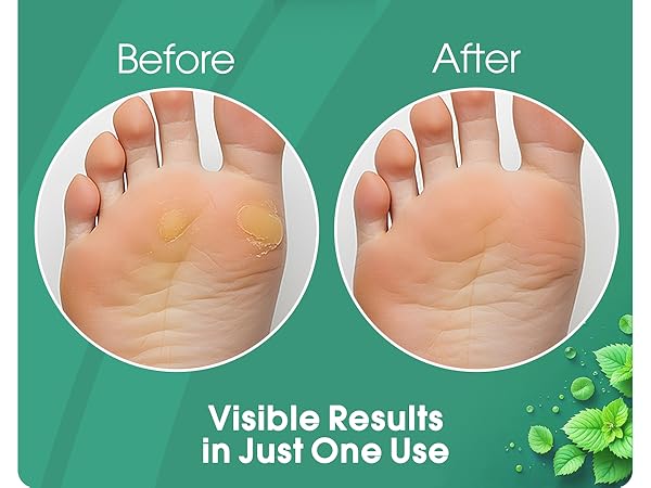 foot scrubber callus remover for feet pedicure tools for feet foot spa cuticle remover
