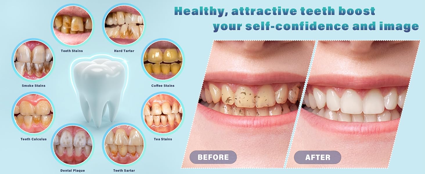 dental cleaner