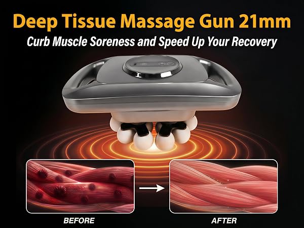21mm Deep Tissue