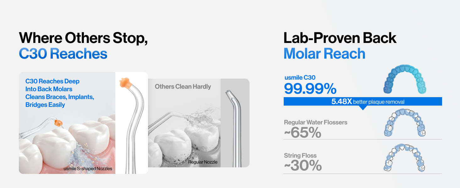 water flosser