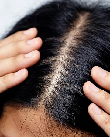Scalp