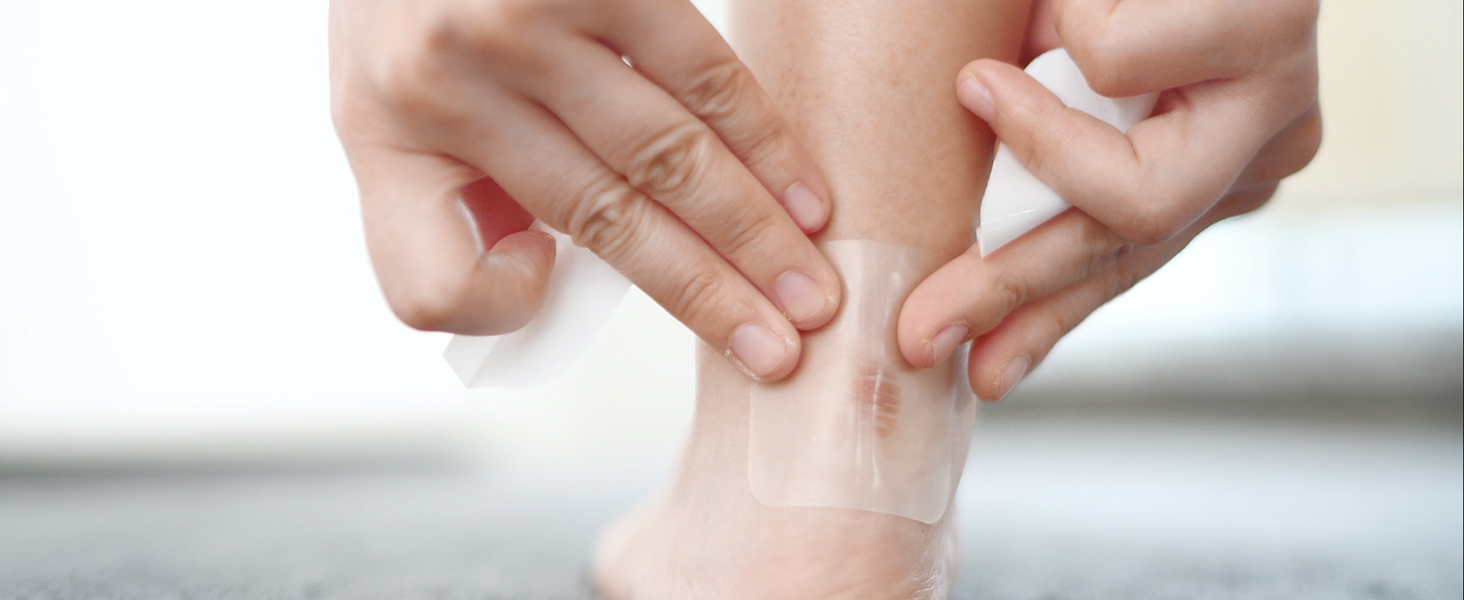 Hydrocolloid Wound Dressing