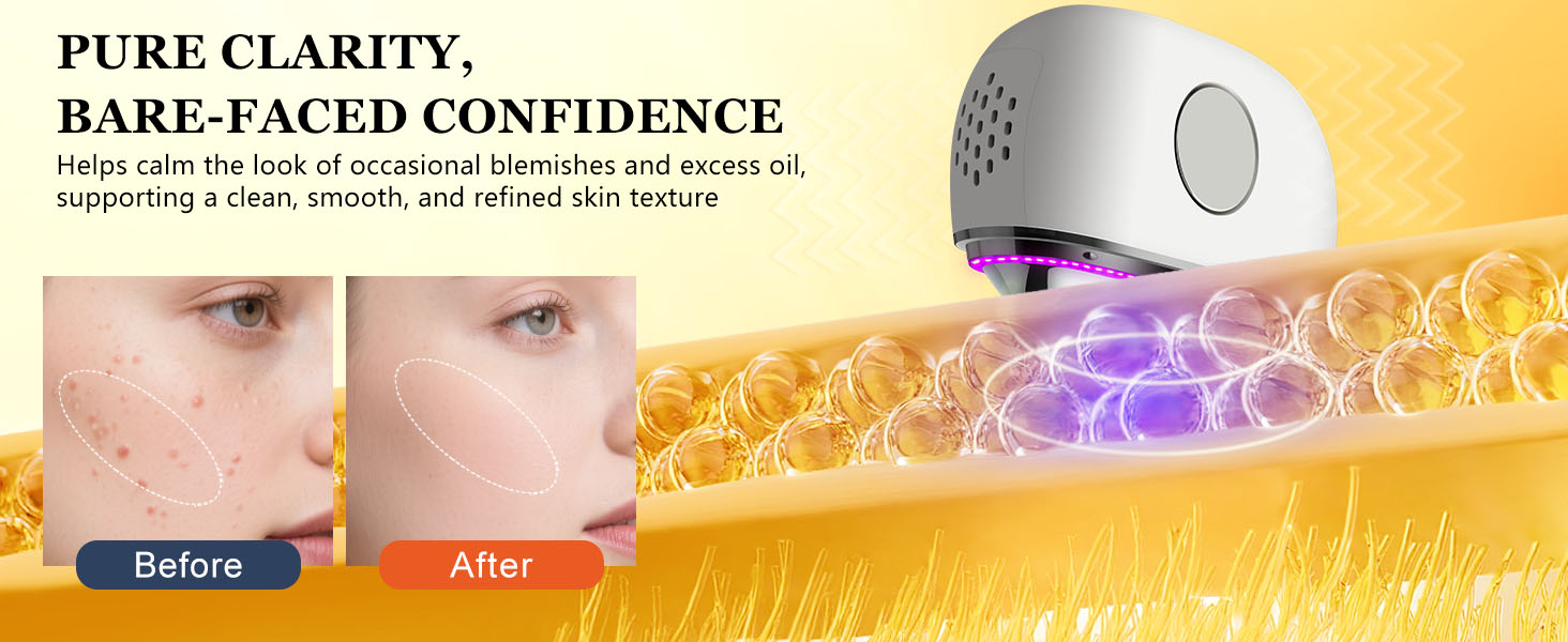 Purple & Blue Light – Clarify the Epidermis