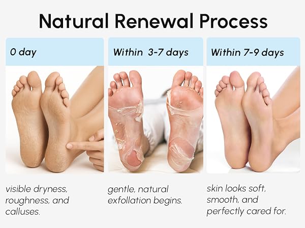 overnight foot mask peeling feet treatment foot exfoliant peach foot balm heel