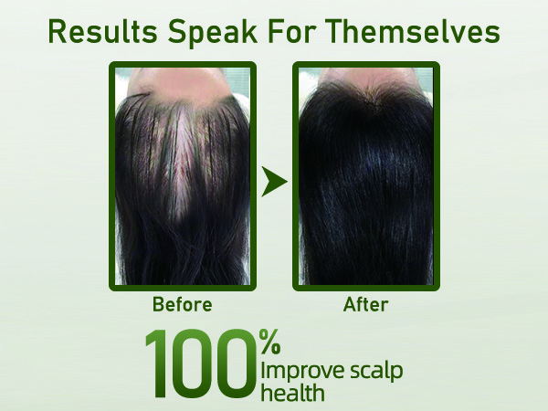 Rosemary Shampoo for Hair Growth