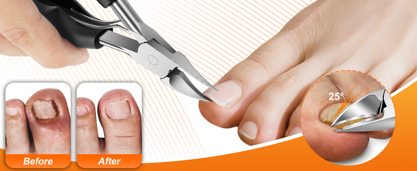 Toenail Clippers for Seniors Ingrown Thick Toenails