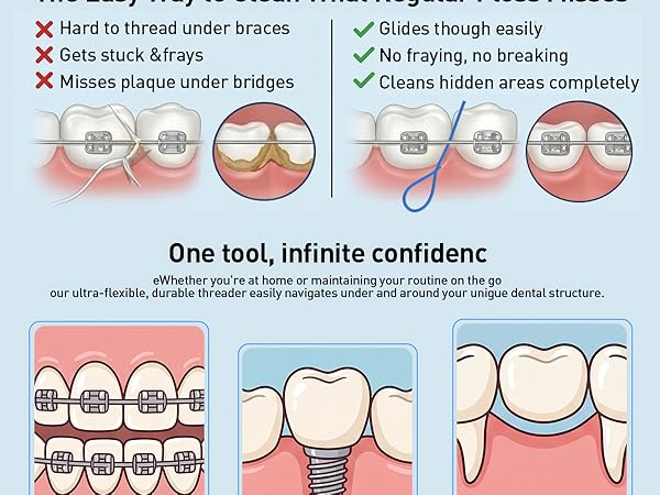 dental floss threader