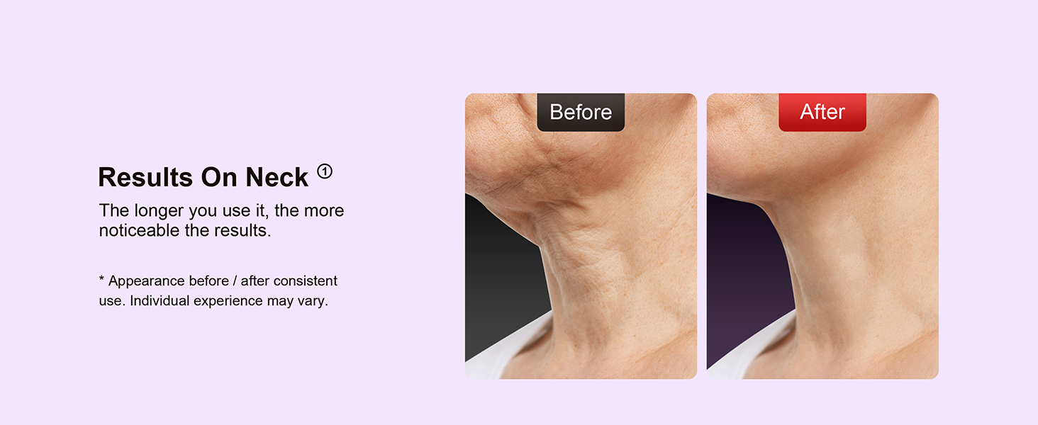 beauty machine for face and neck